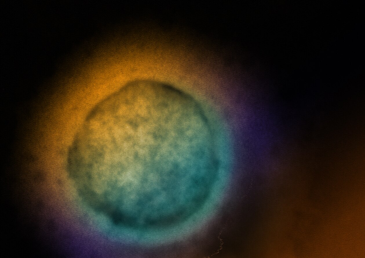 Vírus Nipah, partículas, célula